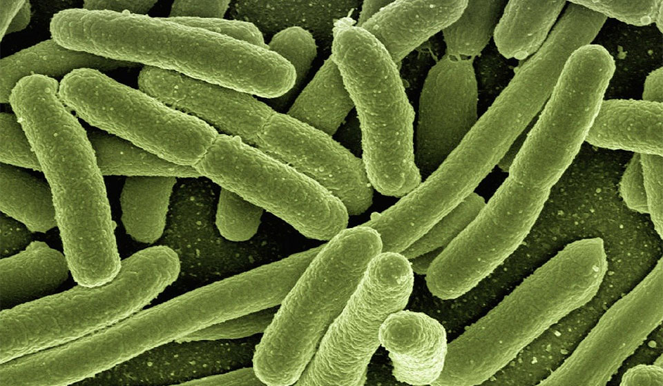¿Cómo limpiar tus auriculares? 1 auriculares bacterianos